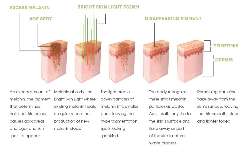 Dr. Muller Bright Skin Light with explanation