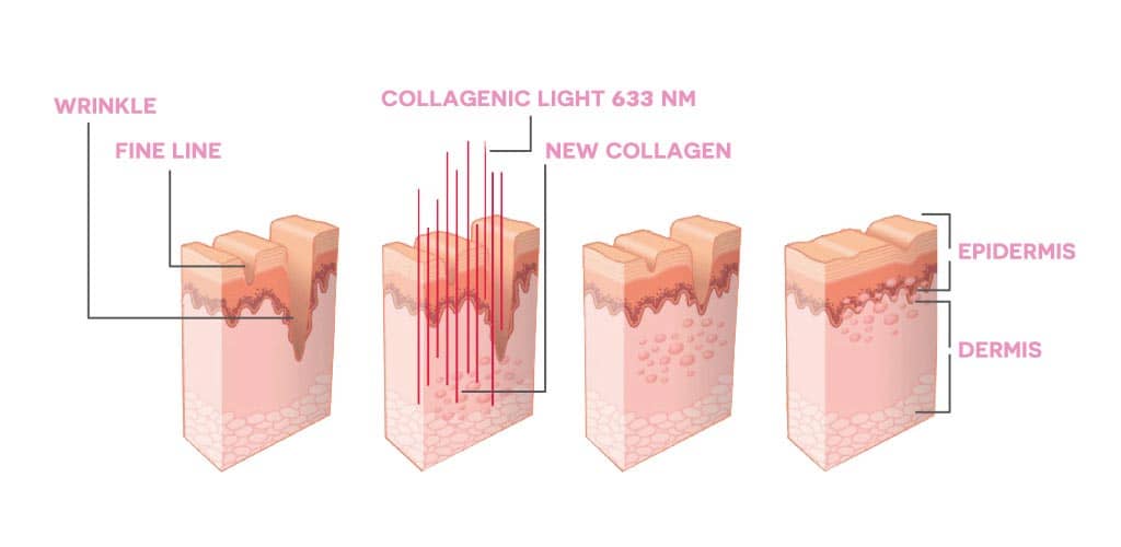 Dr. Muller Collagenic Light impact on skin