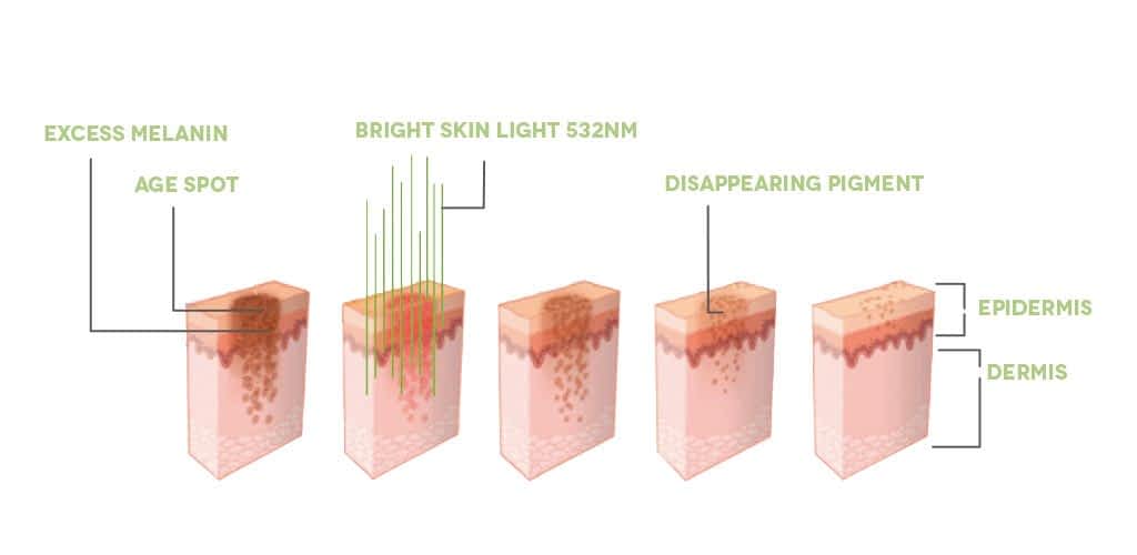 Dr. Muller Bright Skin Light impact on skin