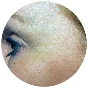 Dr. Muller testimonial