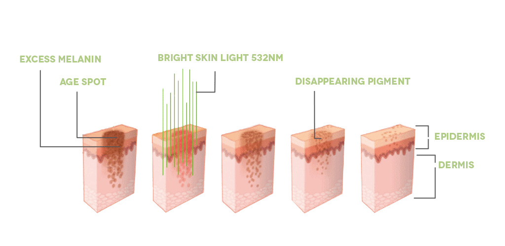 Dr. Muller Bright Skin Light